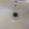 Sarro en lavabo de sanitario